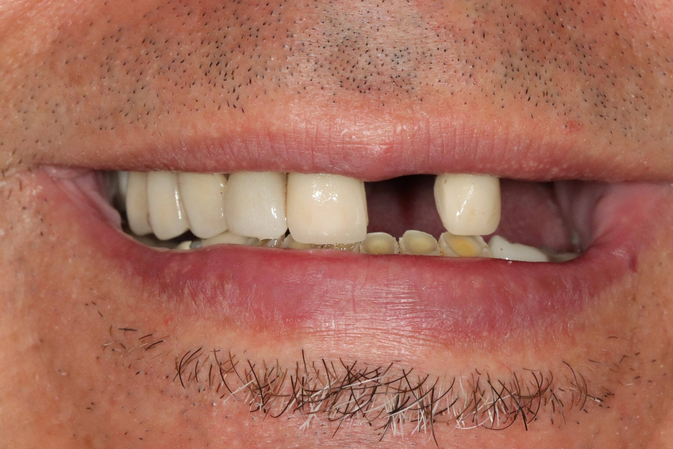 Case 10, before treatment