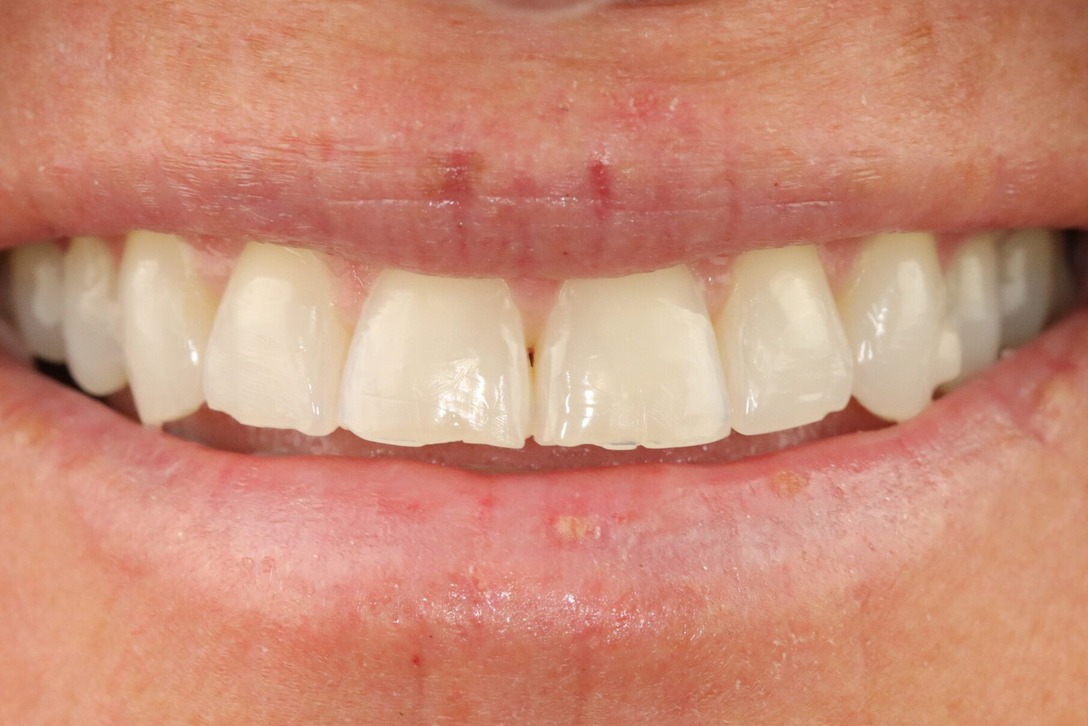Case 22, before treatment