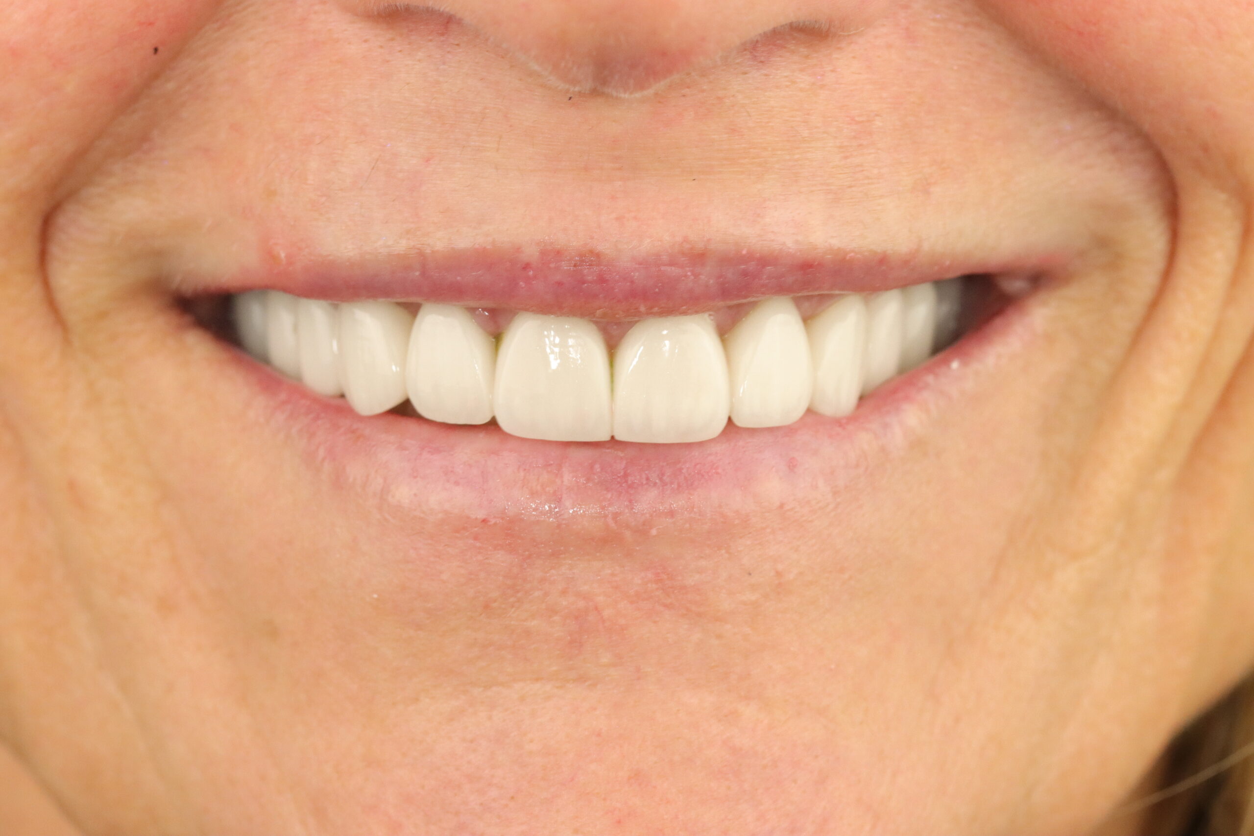 Case 2, after treatment