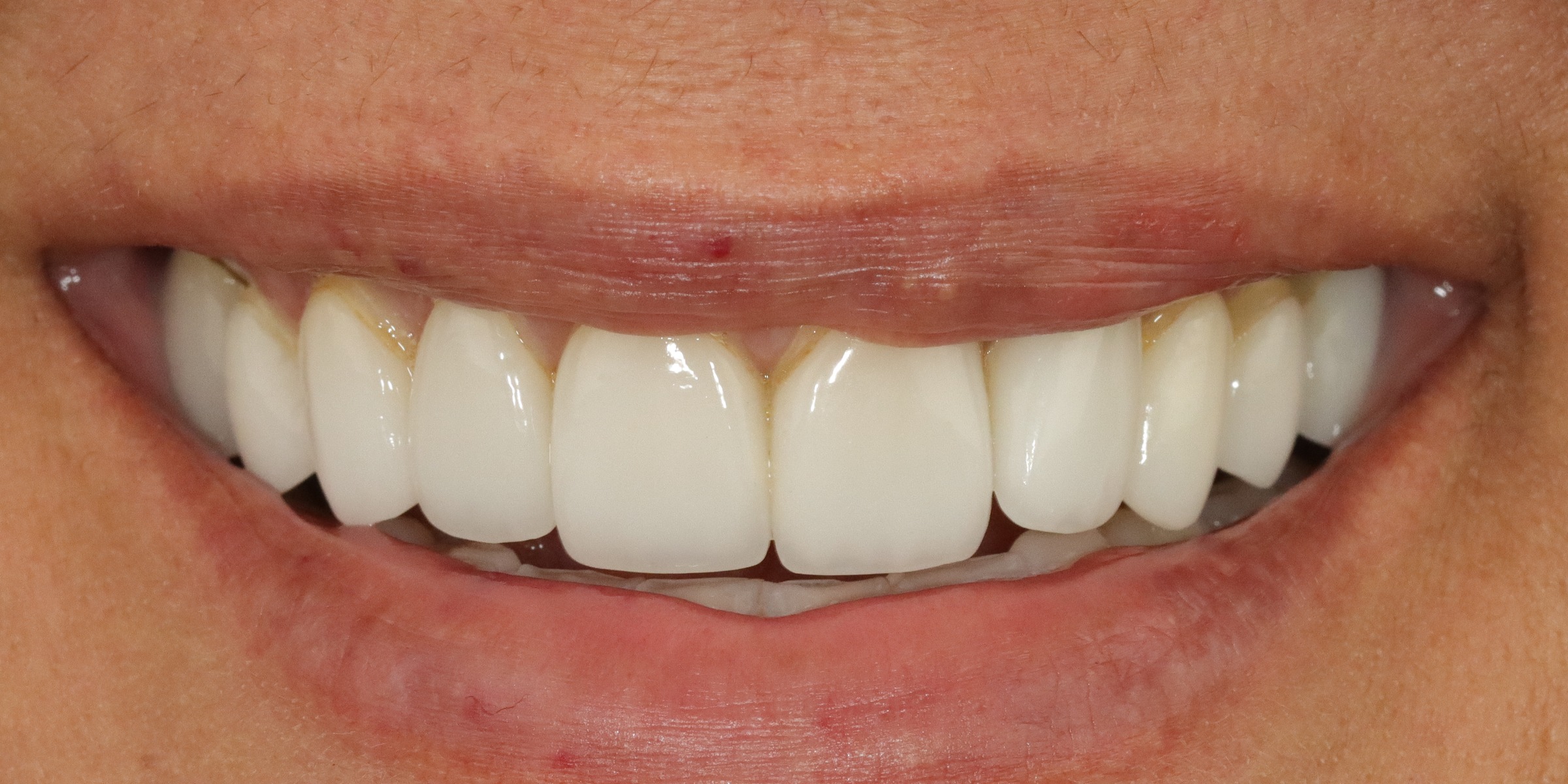 Case 4, before treatment