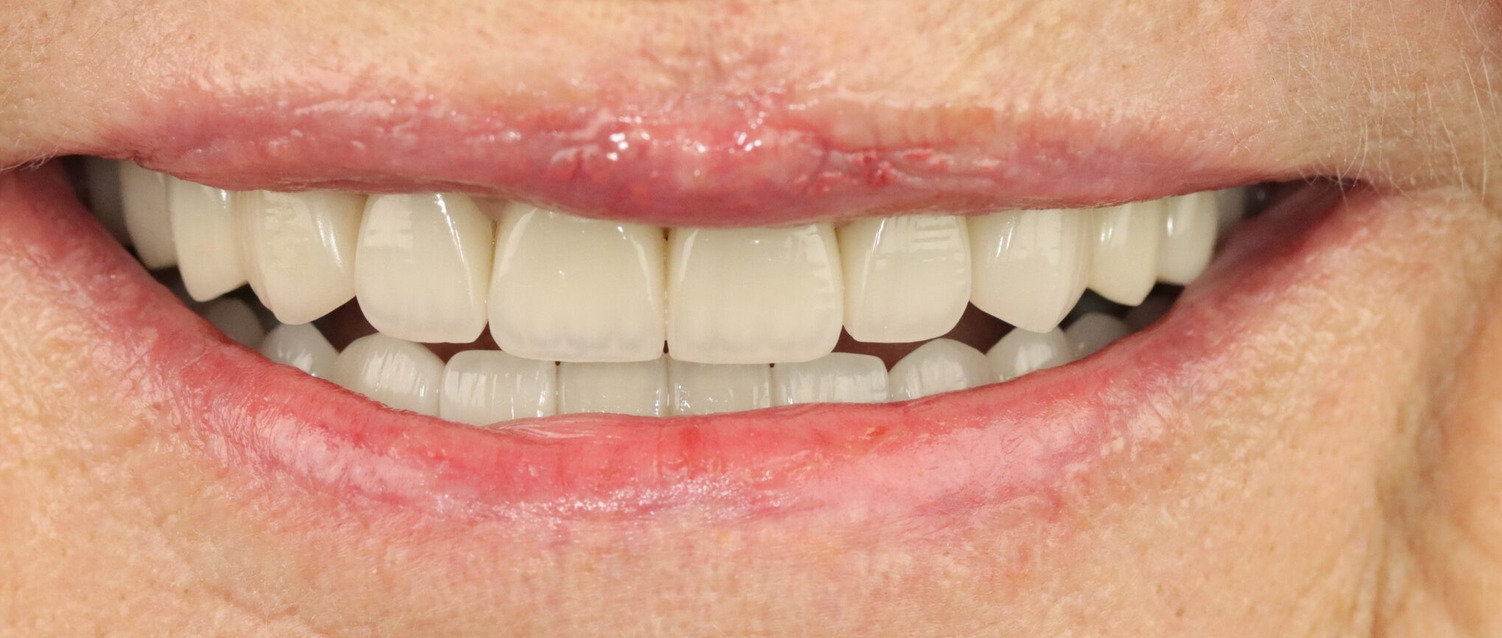 Case 6, after treatment