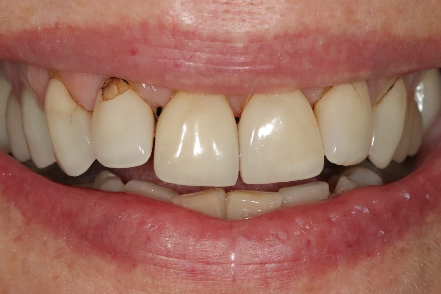Case 12, before treatment