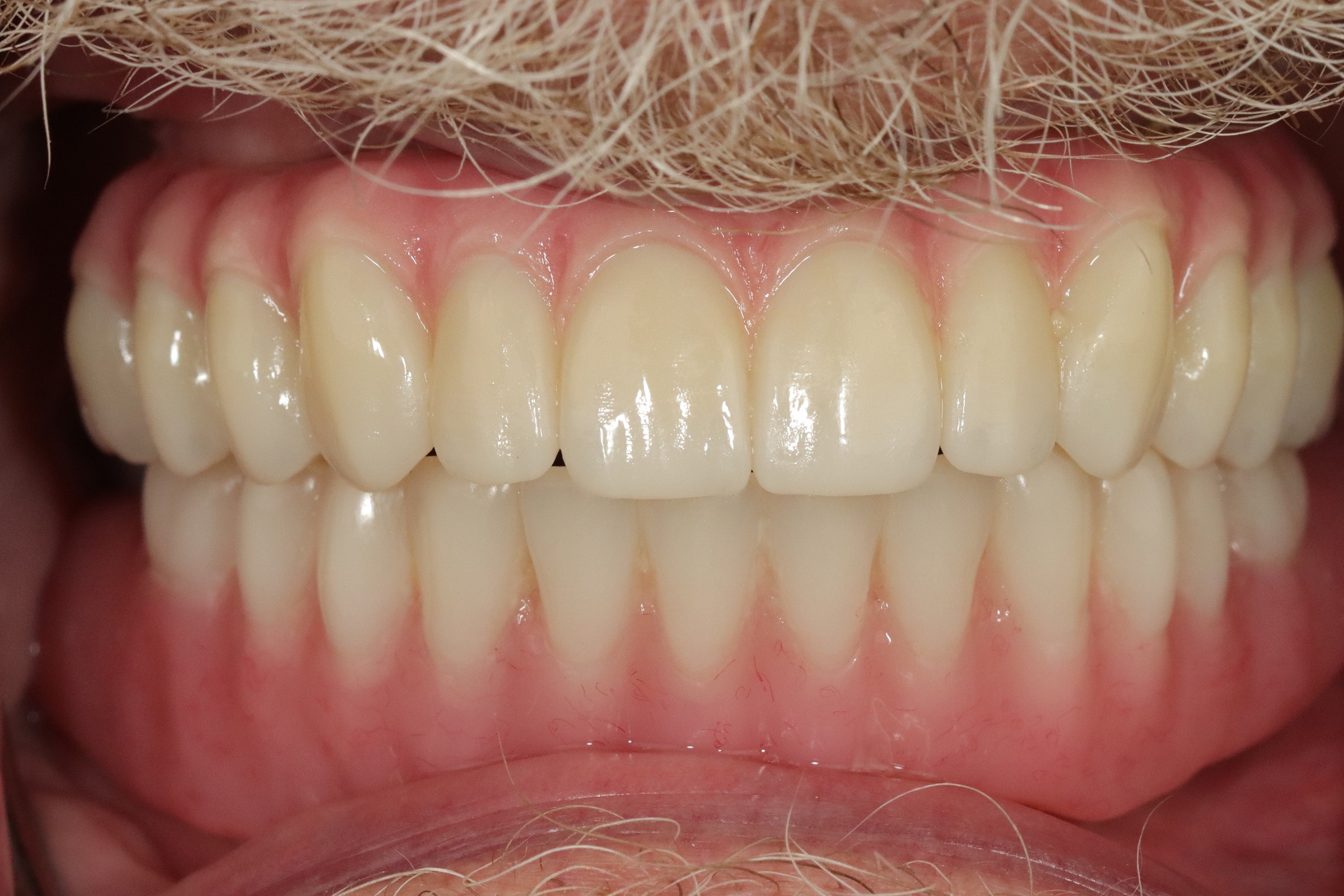 Case 8, after treatment