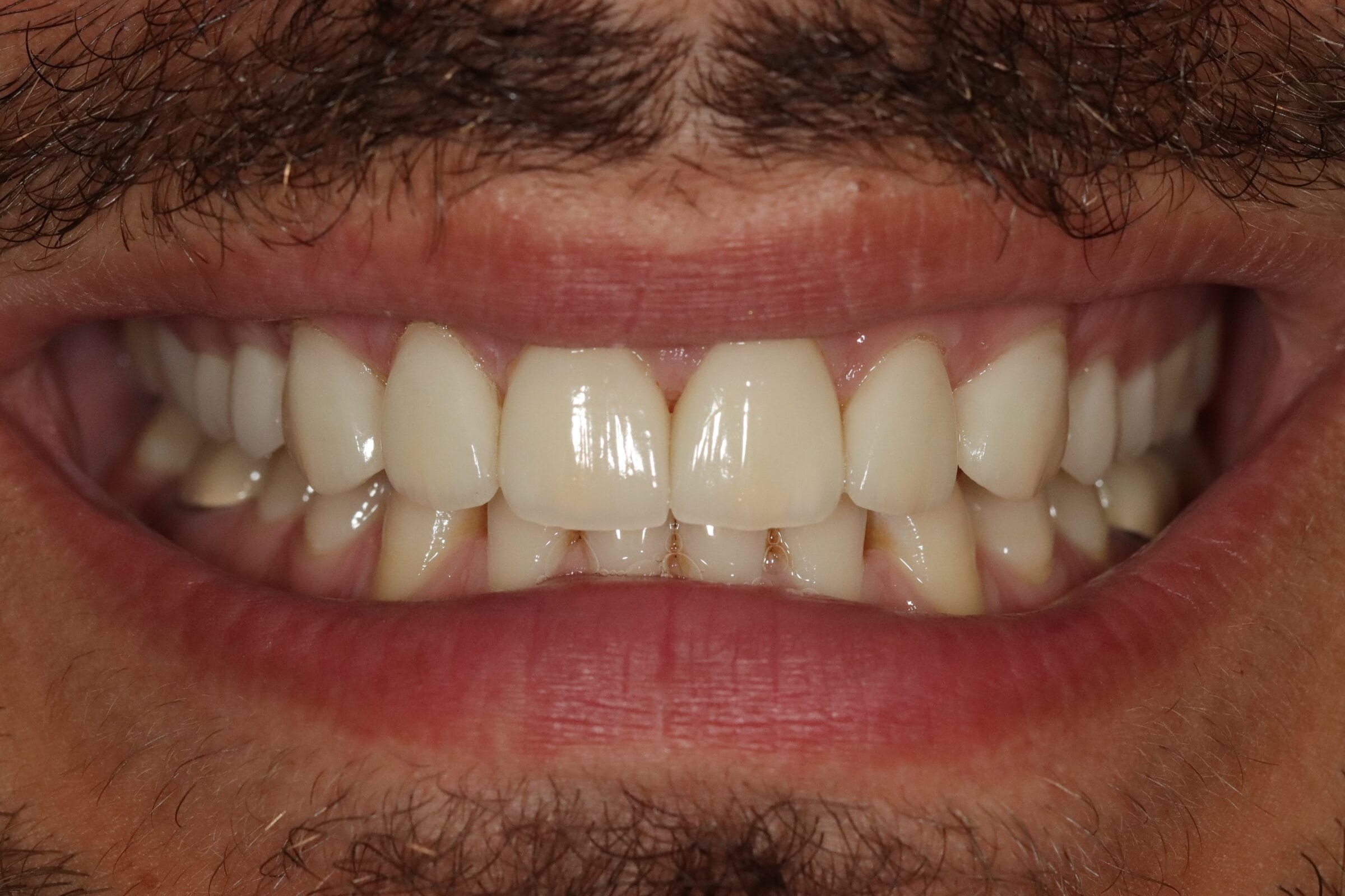Case 9, after treatment