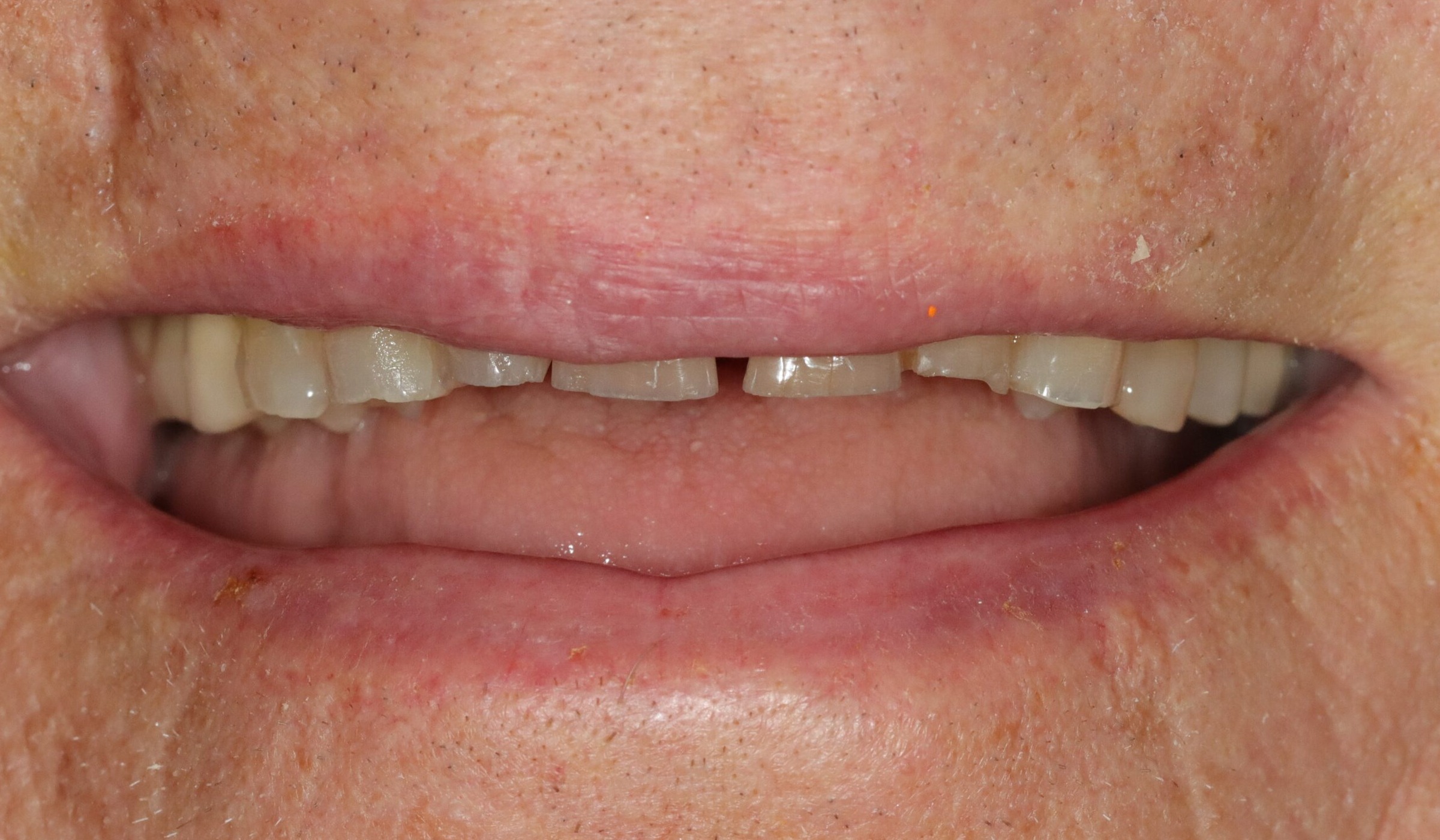 Case 11, before treatment
