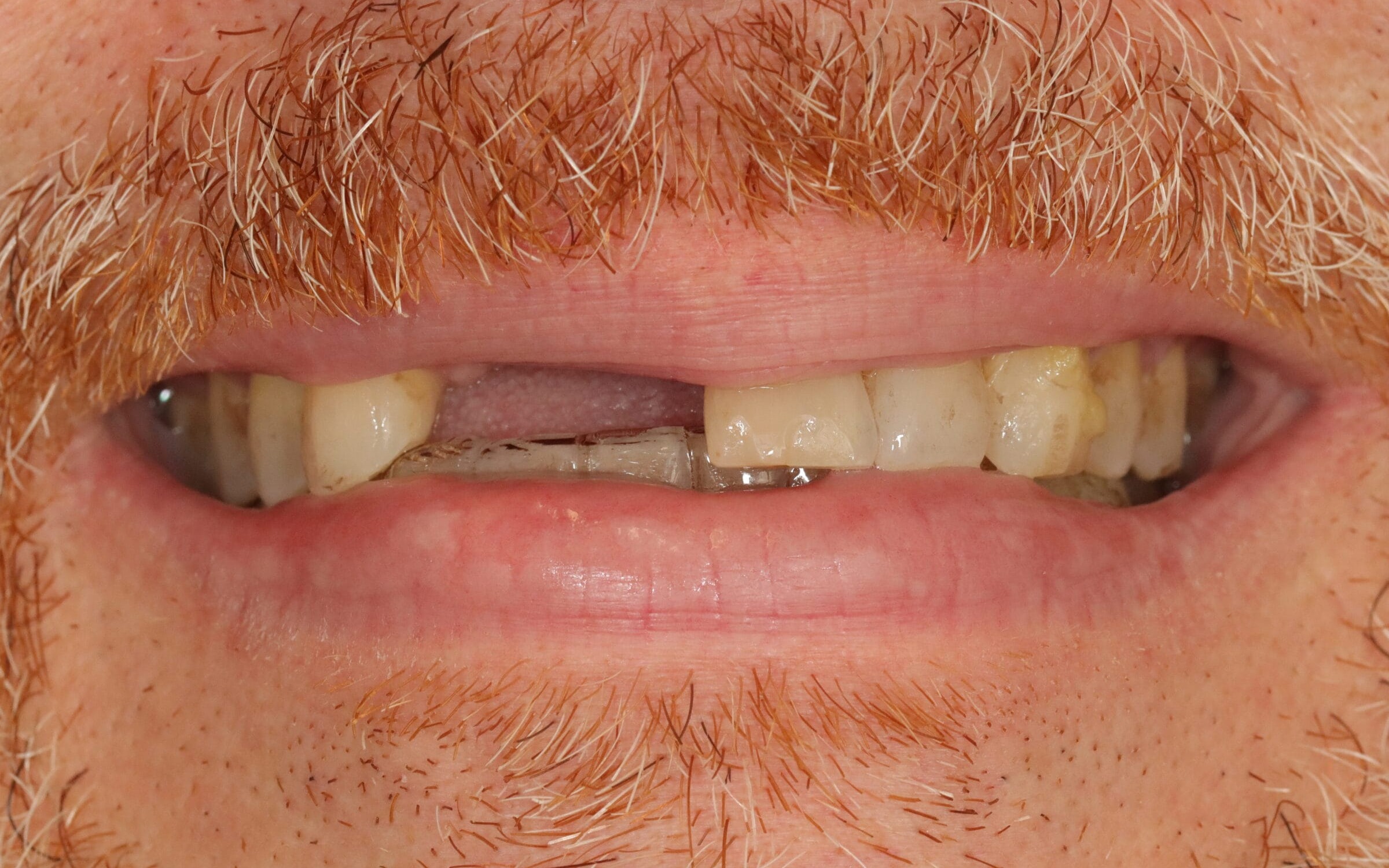 Case 17, before treatment
