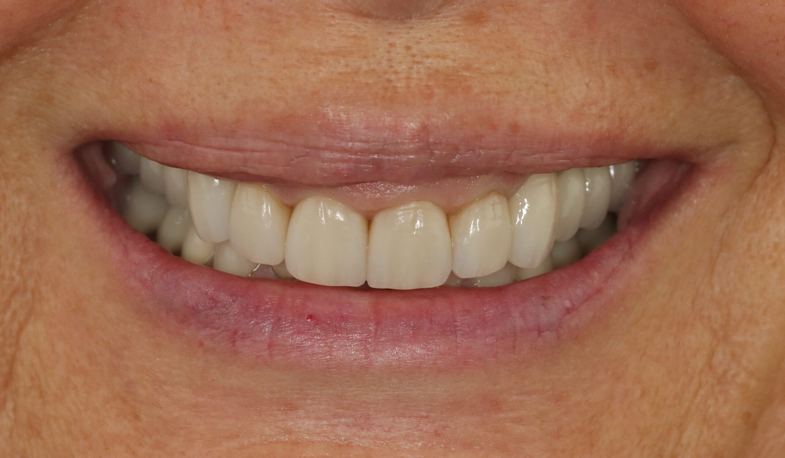 Case 1, before treatment
