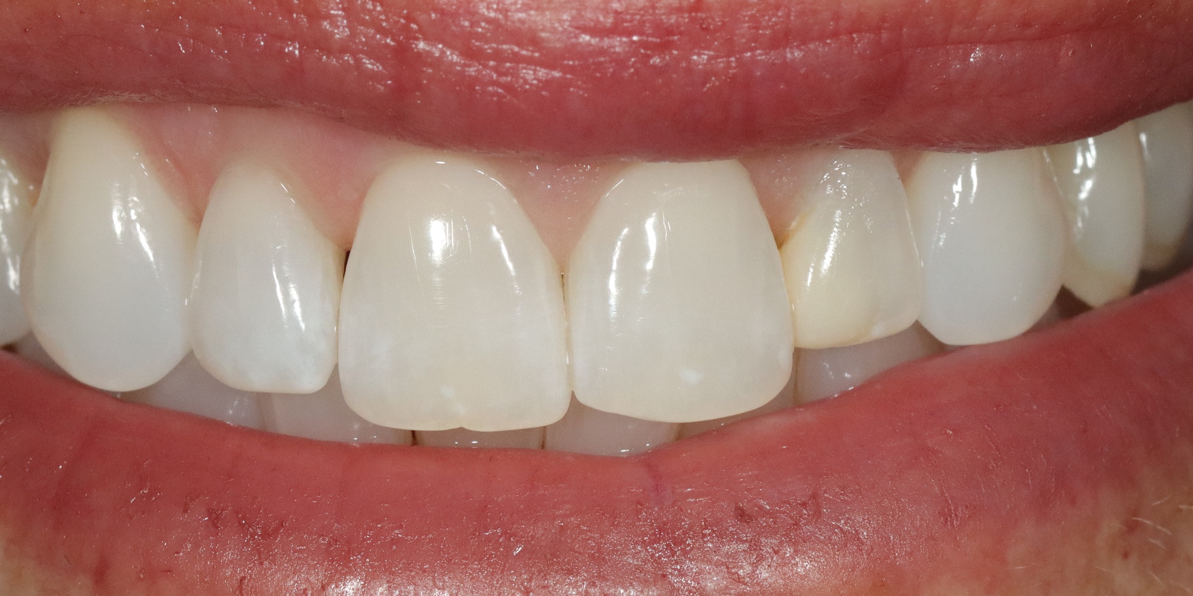 Case 16, before treatment