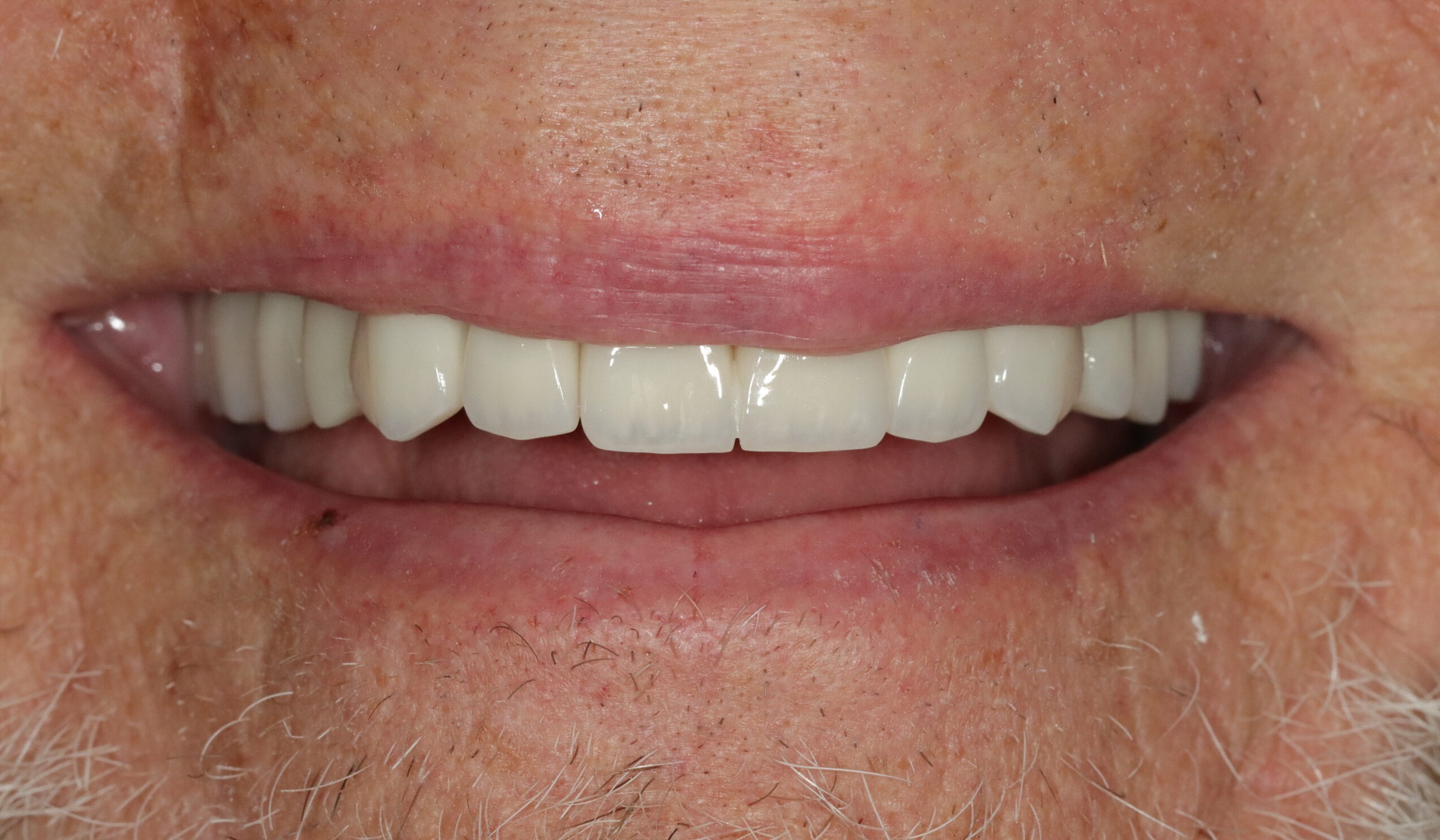Case 11, after treatment