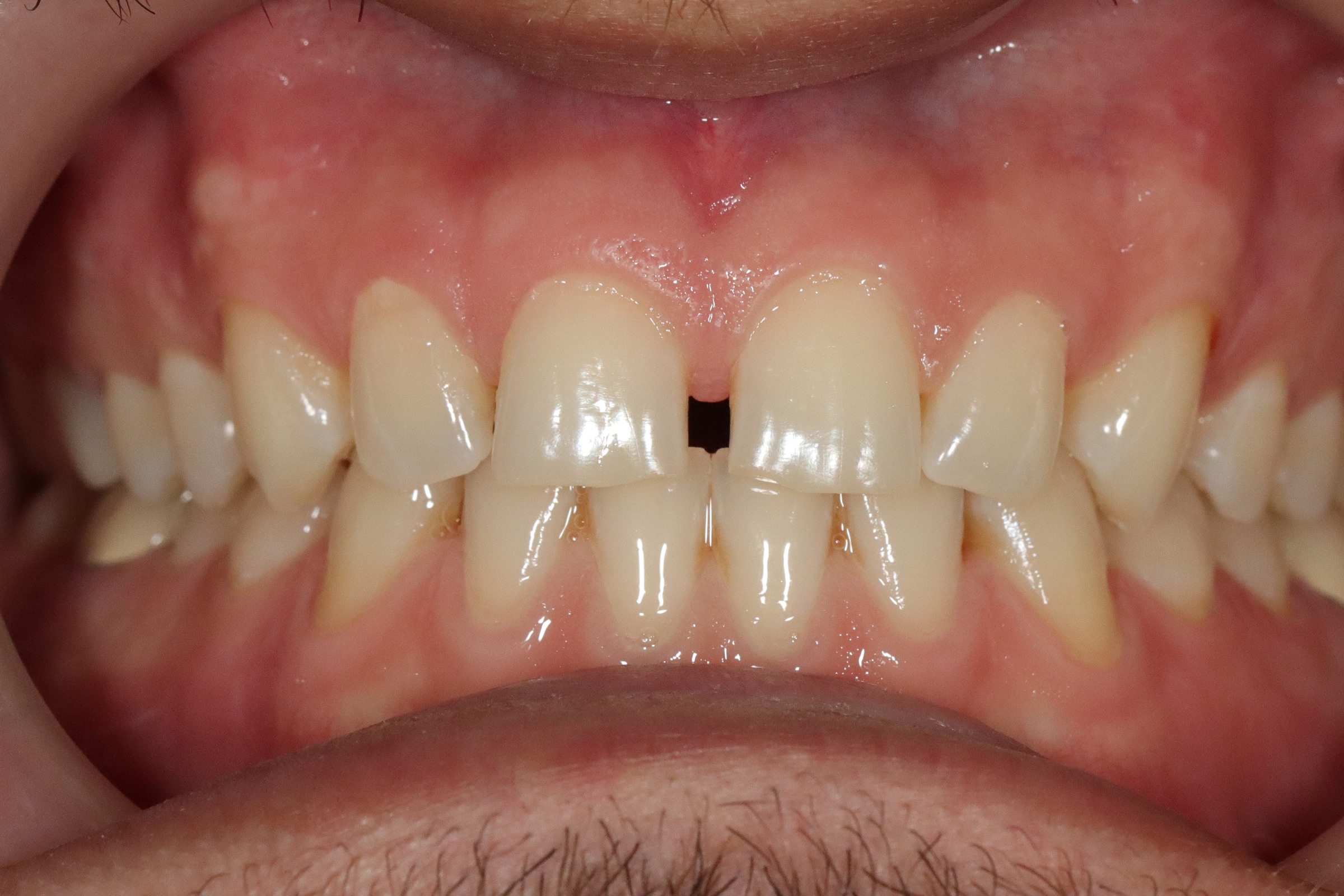 Case 9, before treatment