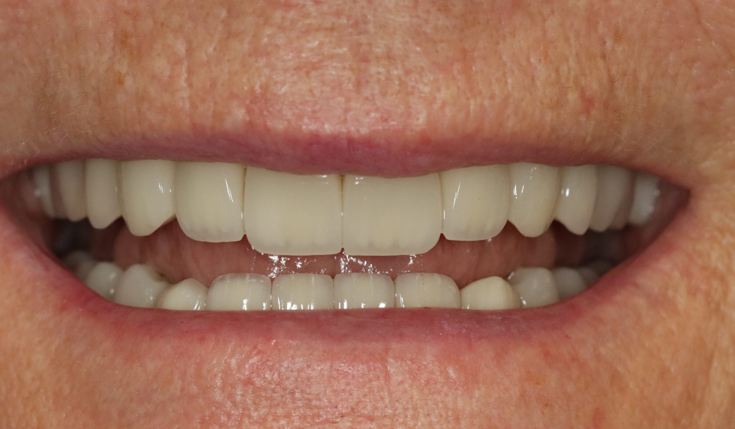 Case 7, after treatment