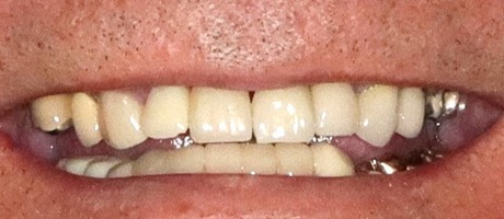 Case 5, before treatment