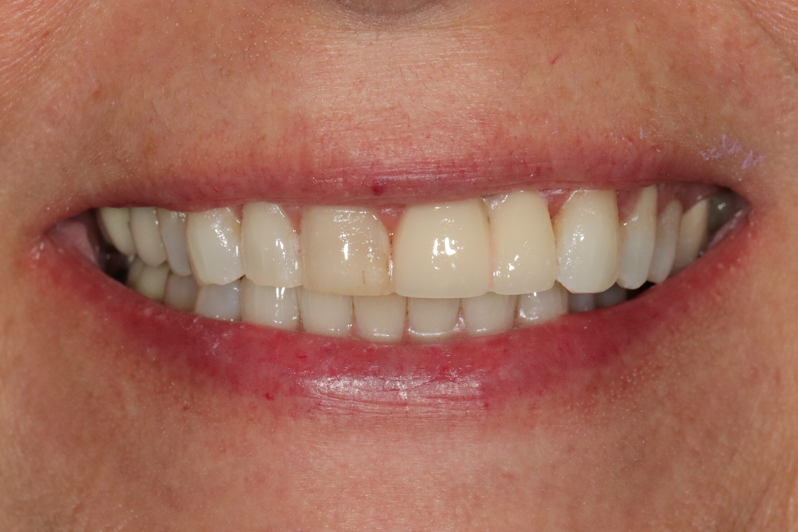 Case 3, before treatment