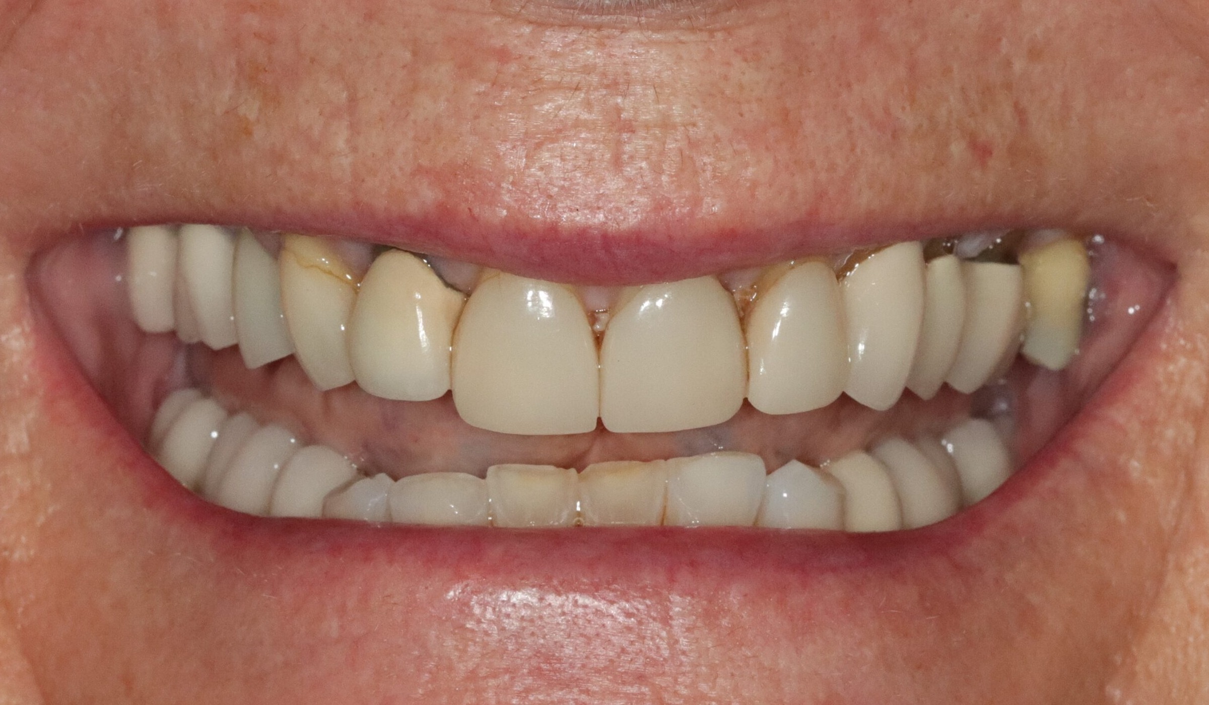 Case 7, before treatment