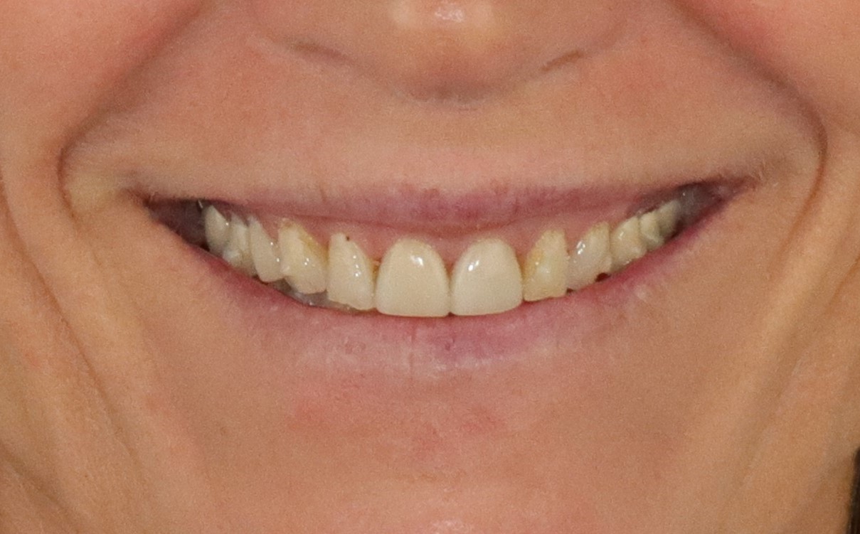 Case 2, before treatment